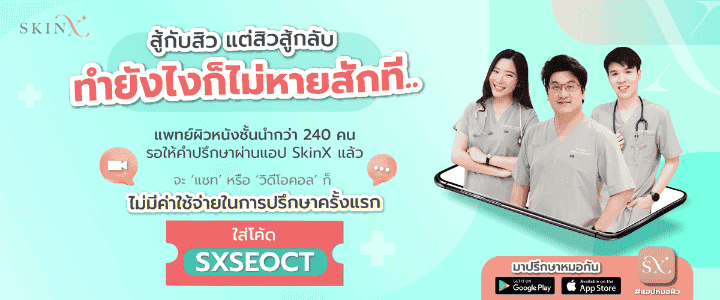 สิวหัวหนอง ปัญหาผิวที่ไม่ใช่เรื่องสิว ๆ จะรักษาอย่างไรดี