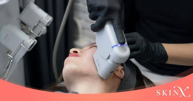 HIFU คืออะไร อันตรายไหม? หลังยกกระชับผิวอยู่ได้นานไหม