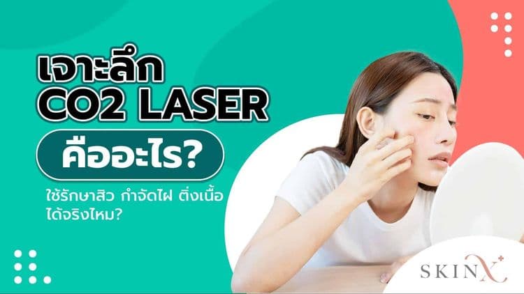 CO2 Laser เทคโนโลยีรักษาปัญหาสิว ไฝ กระ ติ่งเนื้อได้อย่างมีประสิทธิภาพ