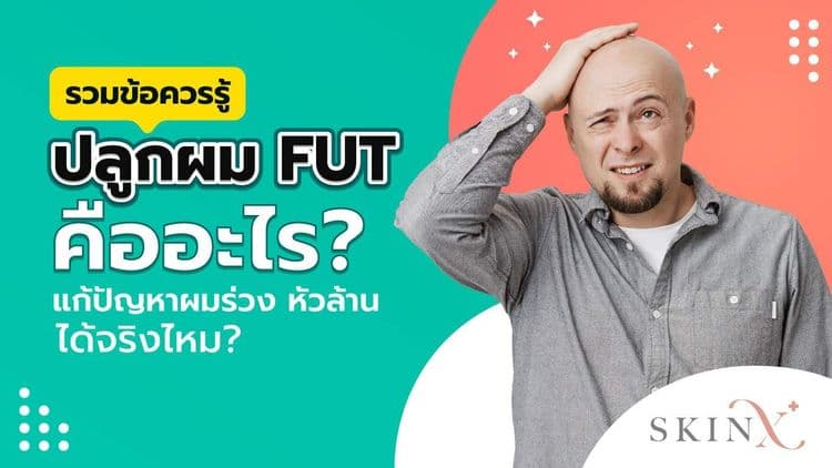 ข้อควรรู้ก่อน “ปลูกผม FUT” แก้ปัญหาผมร่วง ศีรษะล้าน ประสิทธิภาพสูง