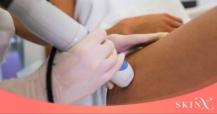 ทำ Thermage ที่ไหนดี? เลือกให้ปลอดภัยและได้ผลลัพธ์ชัดเจนตามที่คาดหวัง