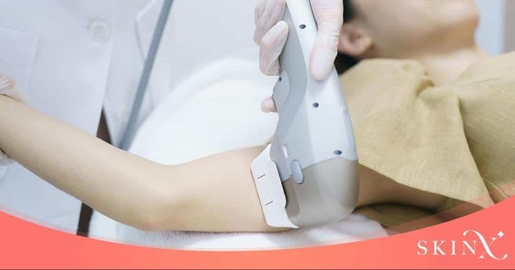 รีวิวเครื่อง Ultraformer III ยกกระชับผิวดีจริงไหม ต่างจากเครื่อง HIFU อื่นอย่างไร?