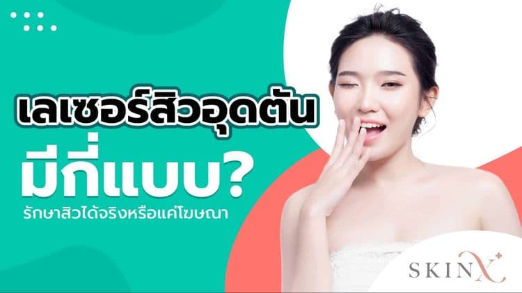 ทำความรู้จัก “เลเซอร์สิว” ทางเลือกจัดการสิวที่ได้ประสิทธิภาพสูงสุด