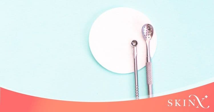 สิวเสี้ยน (Trichostasis Spinulosa) สาเหตุการเกิด และ วิธีการรักษา