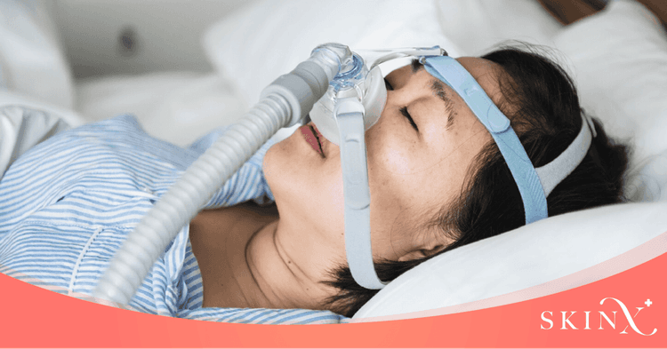 เครื่องช่วยหายใจ CPAP แก้ไขปัญหาการนอนหลับได้จริงหรือไม่?