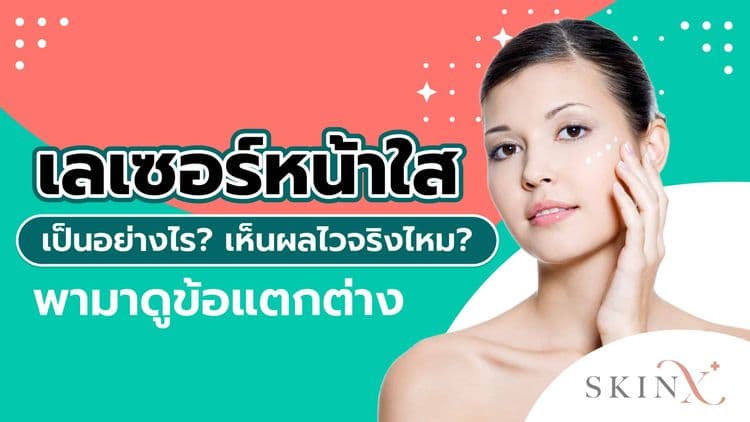 ทำความรู้จัก “เลเซอร์หน้าใส” ช่วยแก้ปัญหาผิวหมองคล้ำ