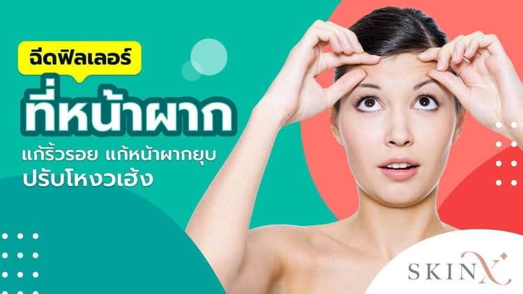 ฉีดฟิลเลอร์หน้าผาก แก้ริ้วรอย เพิ่มความโหนกนูน