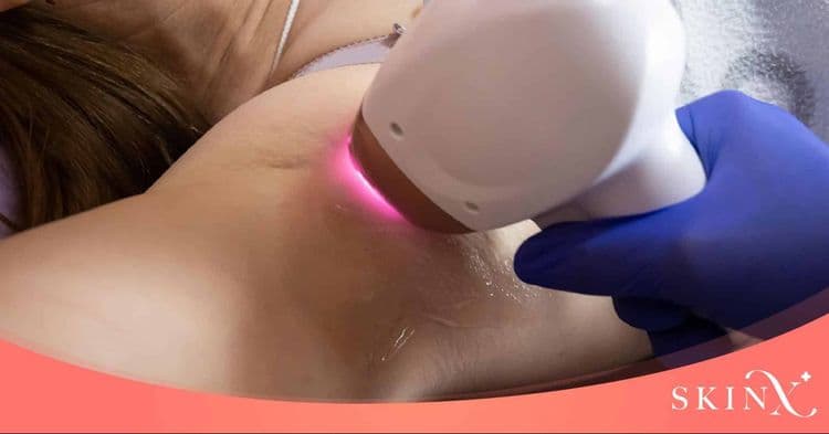 IPL เทคโนโลยีทางเลือกเพื่อแก้ปัญหาผิวอย่างครอบคลุม