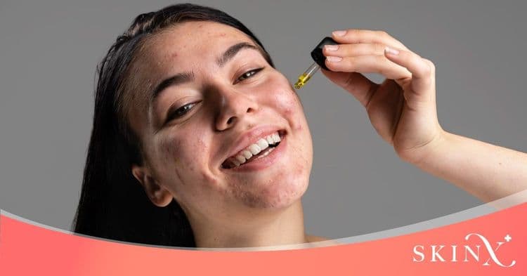 รู้จักผิวแพ้ง่ายและผิวบอบบาง ดูแลผิวอย่างไรถึงเห็นผล