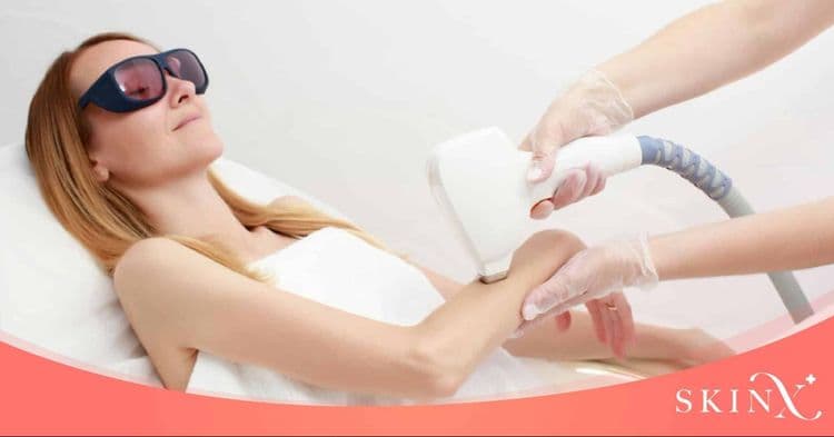 ข้อควรคำนึง เลือกเครื่อง IPL อย่างไรให้ปลอดภัย ลดผลข้างเคียง