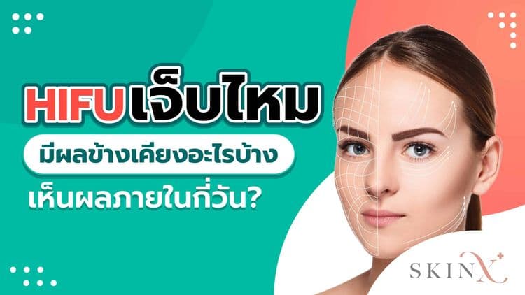 HIFU เจ็บไหม เลือกทำ HIFU อย่างไรให้ปลอดภัย เห็นผลชัดเจน มีผลข้างเคียงน้อย