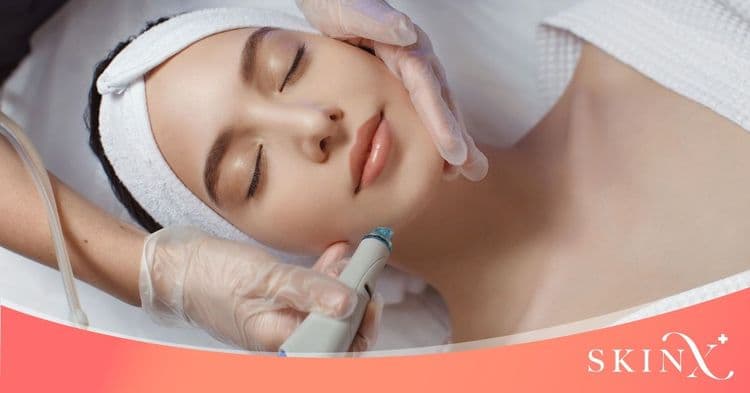 รอยดำรอยแดงบนใบหน้า คืออะไรกันแน่