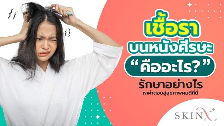 เชื้อราบนหนังศีรษะ ปัญหาที่คอยทำลายความมั่นใจของหลายๆ คน