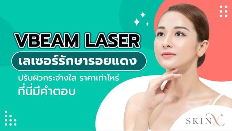Vbeam laser เลเซอร์รักษารอยแดง ปรับผิวกระจ่างใส ราคาเท่าไหร่ ที่นี่มีคำตอบ